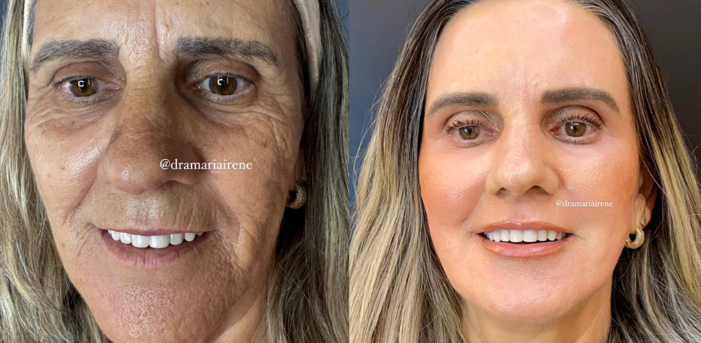 antes-e-dps-9