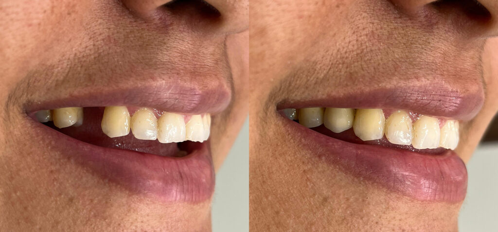 antes-e-depois-2