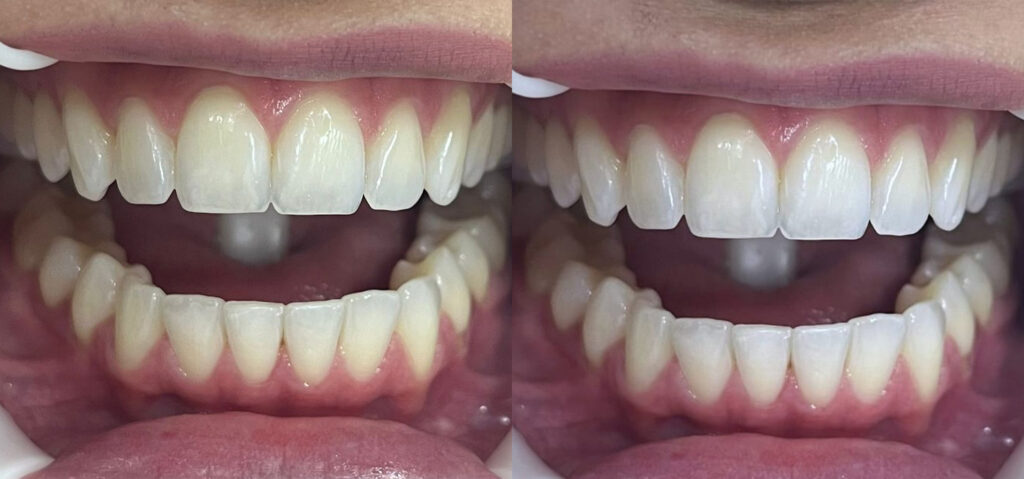 antes-e-depois-3